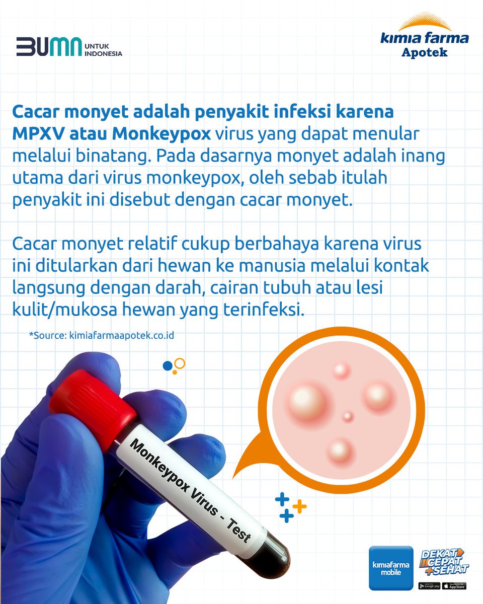 KFMobile_id's tweet photo. Sahabat Kaef, saat ini penyakit cacar monyet menjadi masalah kesehatan yang menjadi perhatian dunia di tengah Covid-19 dan virus hepatitis akut. 

Lalu, seperti apa penularan, gejala dan pencegahannya? 🤔

#KimiaFarmaMobile #DekatCepatSehat #KimiaFarma #KimiaFarmaApotek https://t.co/lWBw1T7m2f