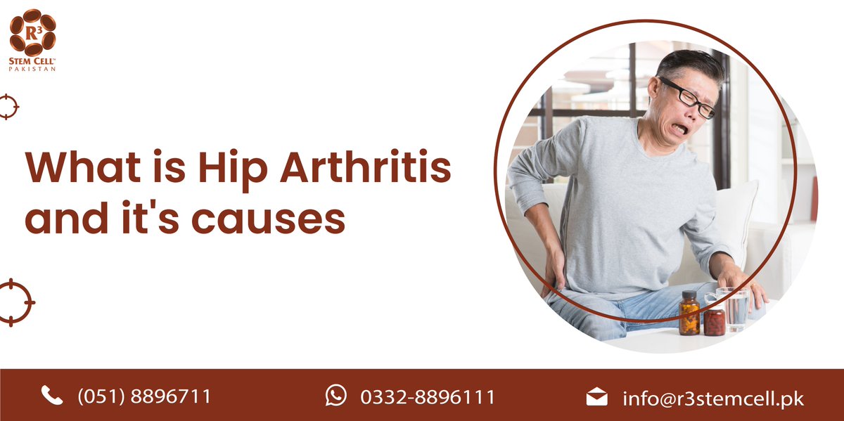 R3StemCellPK's tweet photo. Pain in the hip joint that may include pain in the groin, outer thigh, or buttocks

Email: info@r3stemcell.pk

#hippain #lowbackpain #hipmobility #StemCellTherapy #R3StemCell #hippainrelief #hiparthritis  #arthritis #hipreplacement #arthritic #R3StemCellPakistan #jointreplacement https://t.co/ICY9zXwul2