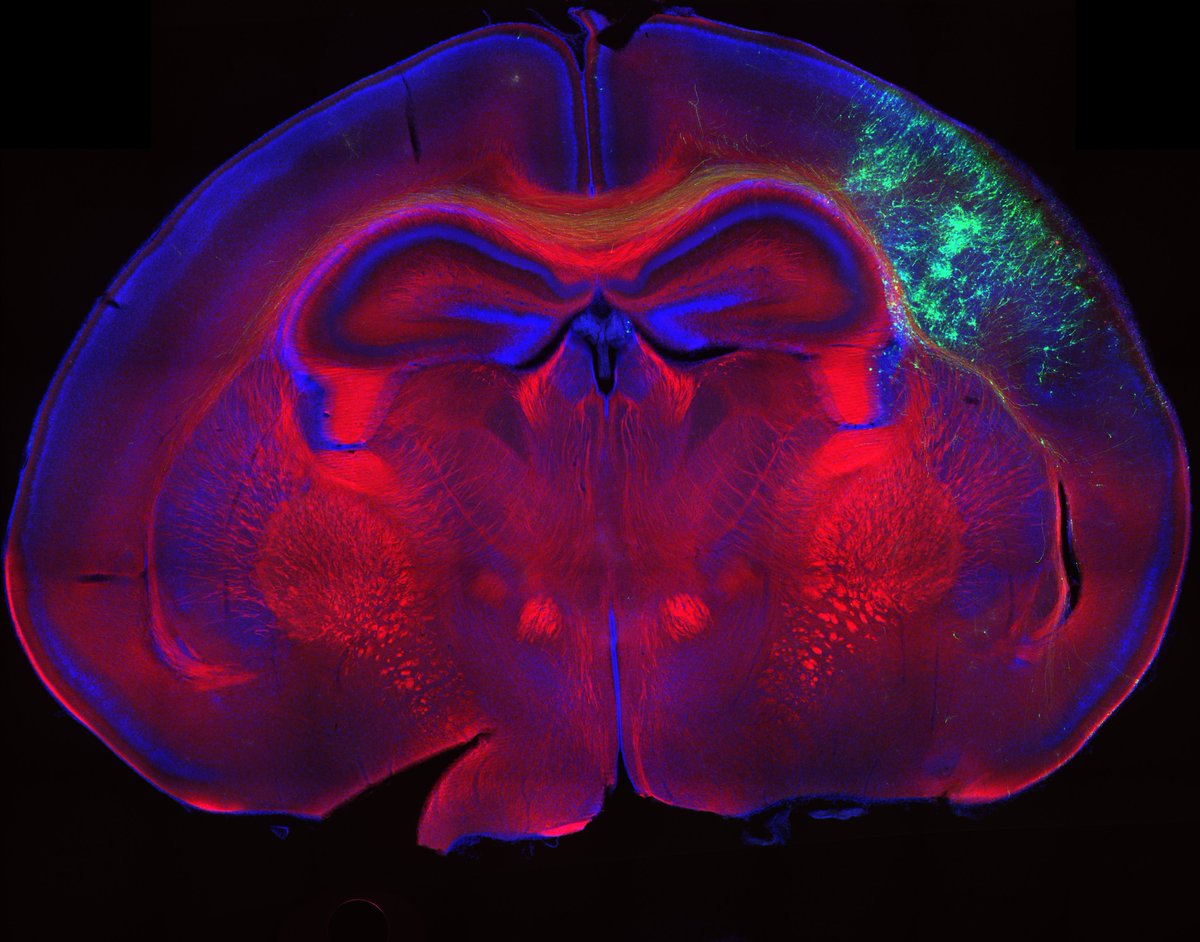 NeuroAlc's tweet photo. #SciencePhoto_IN
"Just stare"
Author: Isabel Pérez @isaabeel_24 and Macarena Herrera @macahgdlh
Lab: Dra. Eloísa Herrera @LabEHerrera
"Mouse cortex section expressing EphB2-GFP (green) and stained with DAPI (cell nuclei, blue) and L1 (axons, red). Imaged @zeiss_micro Axioscan." https://t.co/jgbJBQyAQ2
