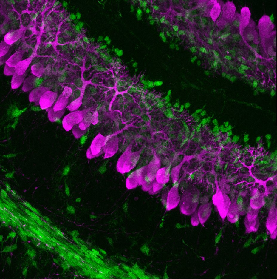 #SciencePhoto_IN
"Cerebellation"
Author: Ana Moreno <a href="/anillu_1997/">Ana</a>
Lab: Dr. Juan Antonio Moreno <a href="/JAMoreno_Bravo/">Juan Antonio Moreno-Bravo</a>
"Sagittal section of 10 days old mouse cerebellum. Migrating interneurons of the granule layer (green) and Purkinje cells (magenta). With <a href="/LeicaMicro/">Leica Microsystems</a> SPEII microscope."