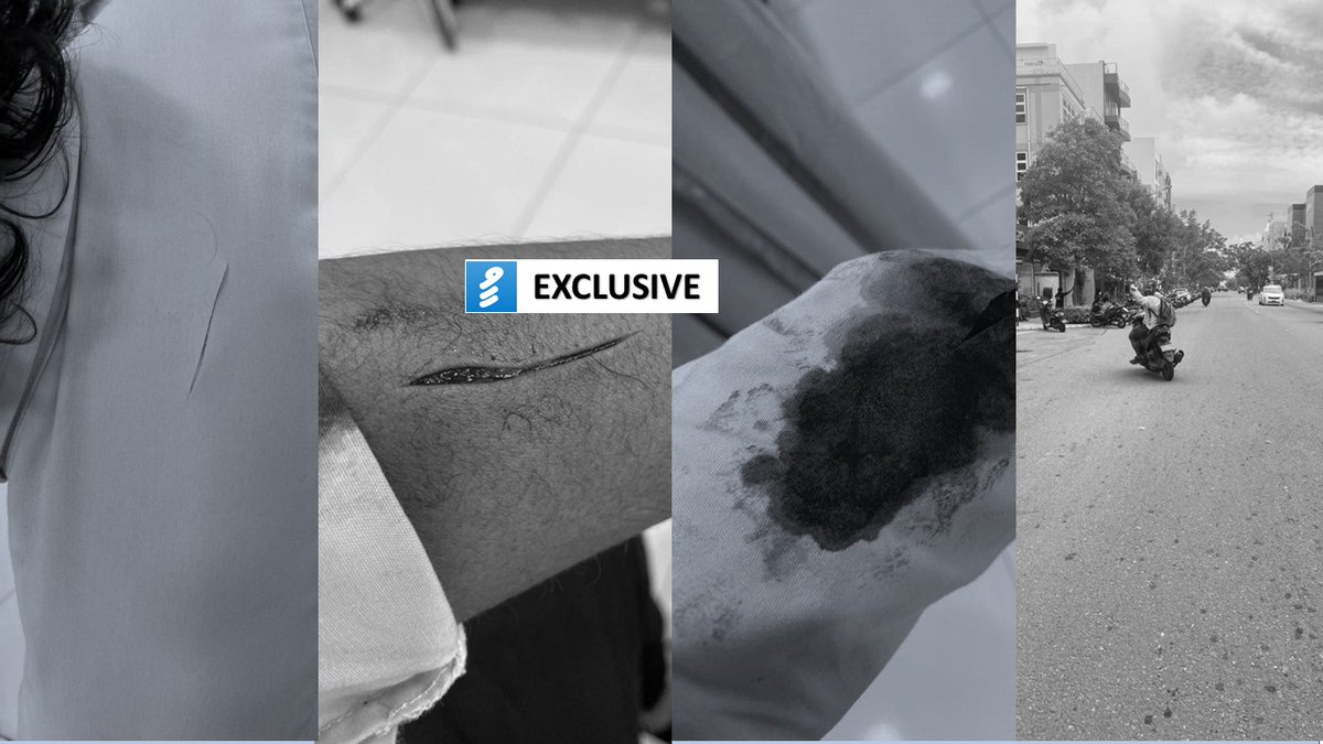 HEaffanmohamed's tweet photo. Minister of State for @MoEnvmv @alisolih has been attacked with a cutter, on the basis of him being a part of the government. The suspect is the guy who got arrested and released a few months ago regarding the Salman Masjid incident https://t.co/4Yn7XwhOEK