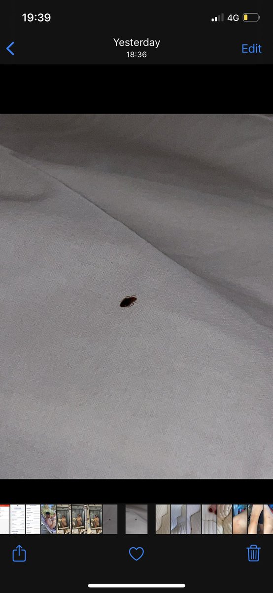 georgiarawly's tweet photo. Not @jet2tweets #jet2 putting us in a 5* hotel and then refusing compensation when we found bed bugs saying there’s no correlation between the bugs in the bed and the 40+ bites on us🙃 stay clear of @VeryChicHotels Gumbet, Turkey https://t.co/UsLSUfUDHF