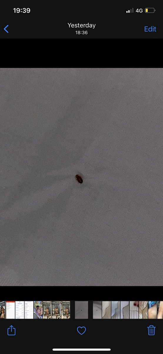 georgiarawly's tweet photo. Not @jet2tweets #jet2 putting us in a 5* hotel and then refusing compensation when we found bed bugs saying there’s no correlation between the bugs in the bed and the 40+ bites on us🙃 stay clear of @VeryChicHotels Gumbet, Turkey https://t.co/UsLSUfUDHF