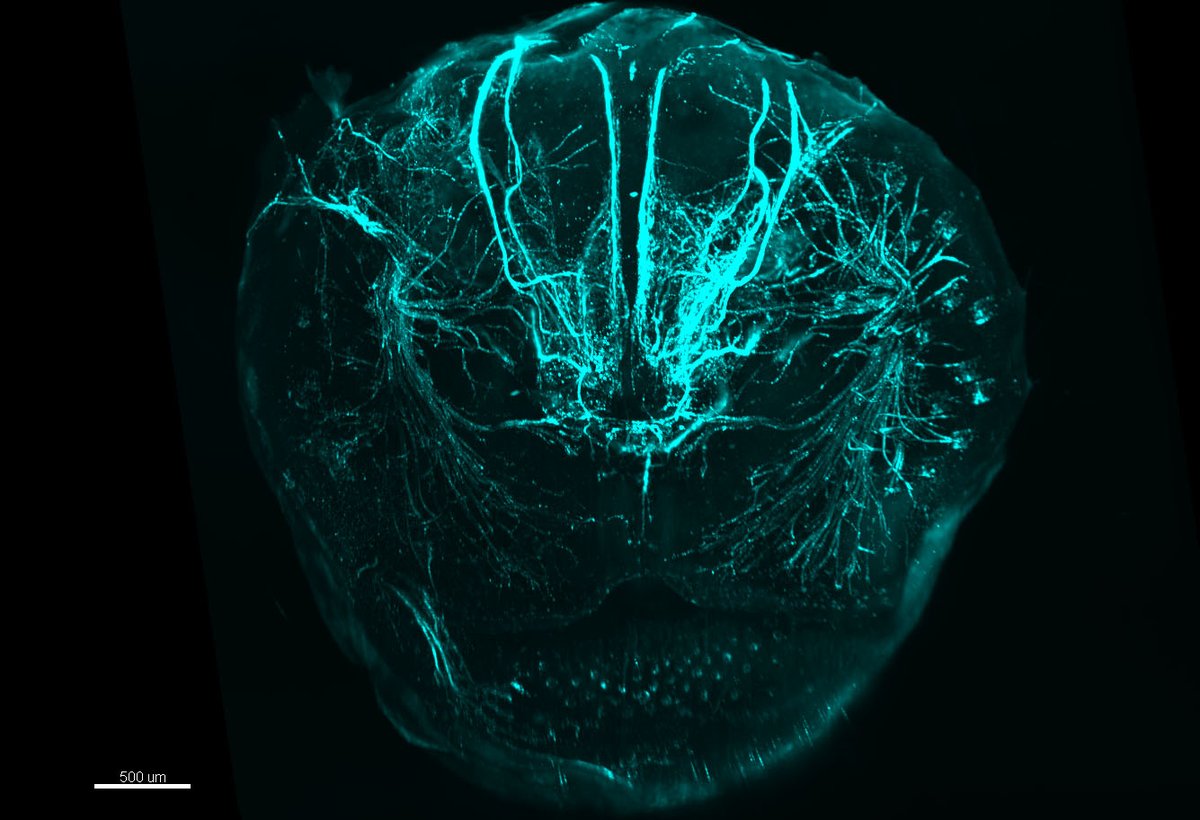 #SciencePhoto_IN
"Nice nose"
Author: Dr. Pilar Madrigal <a href="/pilarmadrigal_/">Pilar</a>
Lab: Dr. Sandra Jurado <a href="/LabSjurado/">SJurado_LAB</a>
"3D visualization of TH nerves in the embryonic mouse snout. Acquired with a <a href="/miltenyibiotec/">Miltenyi Biotec</a> Ultramicroscope II, processed with <a href="/ImarisSoftware/">Imaris 3D/4D Imaging</a>."
