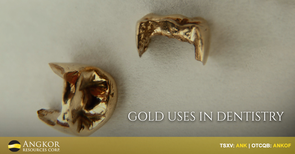 AngkorResources's tweet photo. Did you know?
#Gold was used in #dentistry as far back as 700 B.C!
• It's non-allergenic
• It's malleable
• It doesn't react to other chemicals
Learn more: https://t.co/4Q05bPPR53
#GoldApplication #GoldResource #AngkorResources #TSX #TSXV $ANK $ANK.V #OTC #OTCQB $ANKOF https://t.co/kVvuQ0x2Fn
