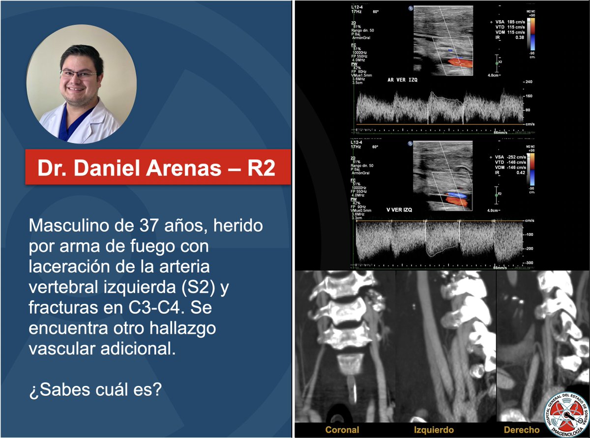 Presentamos el caso de la semana, ¿cual es la patología vascular asociada? #radres #radiology #CT #ultrasound