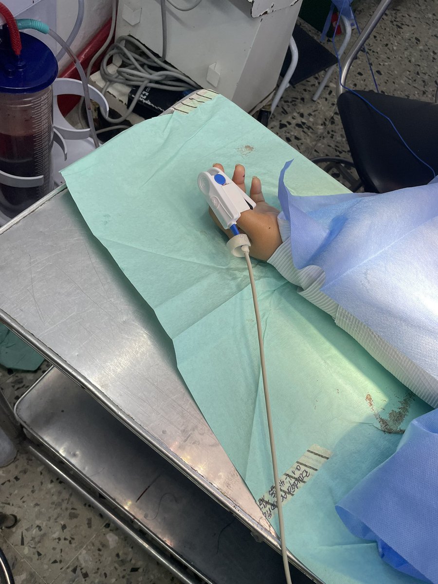 NandoEnriqueTV's tweet photo. First Saphenous Vein Graft as resident due to Grade II AAST Peripheral Vascular Trauma

#FirstOfMany 

#SoMe4Surgery #SoMe4Vascular 
@ascolcirugia @asovascular @PipeCabreraV @juancgomezrco @trasmussen_md @Dr_Tonnessen @vascularium @jmills1955 @garzavascular @XavierBerardMD https://t.co/vMVJ1CuitQ