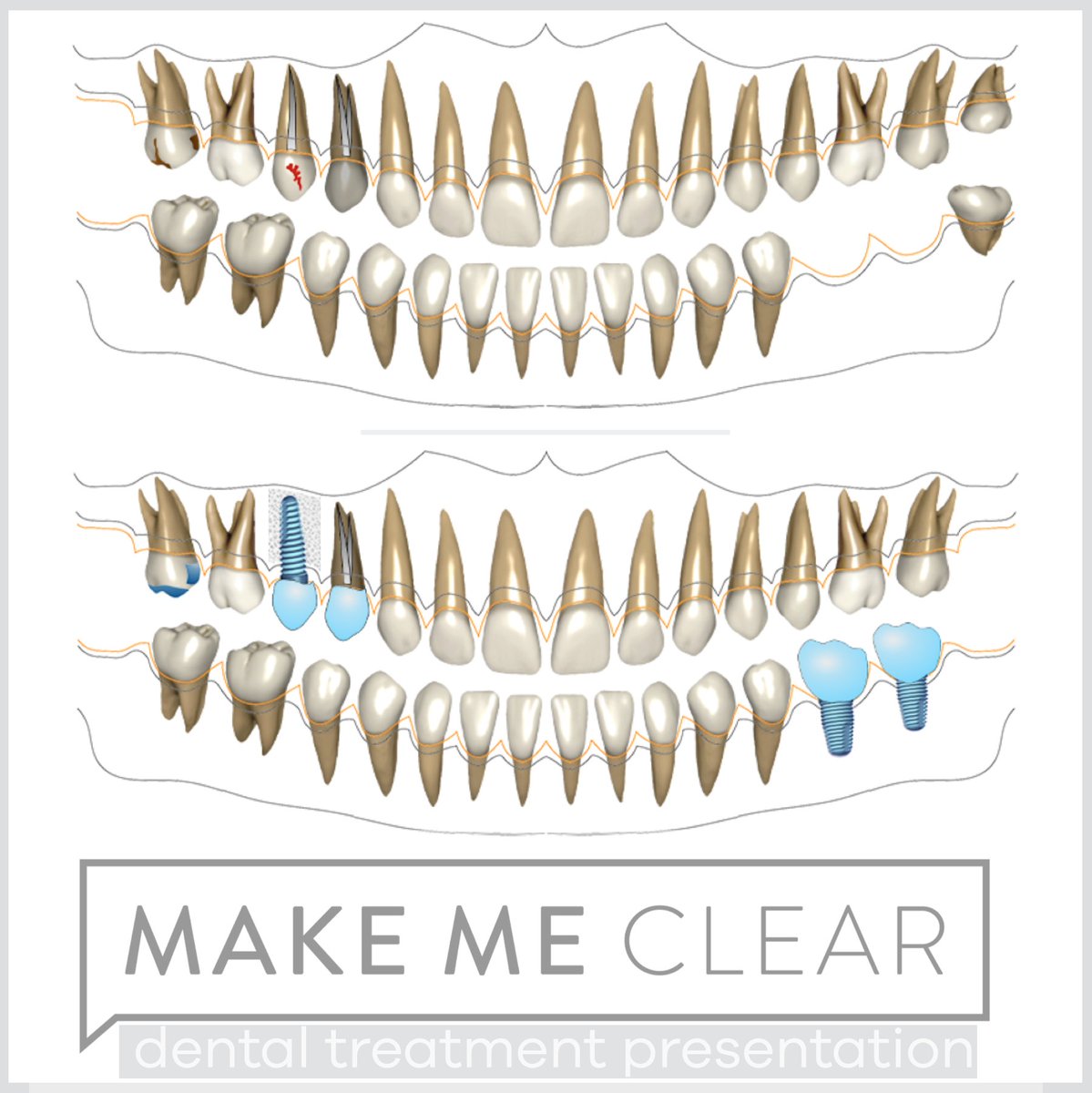 makemeclearapp's tweet photo. https://t.co/GTFH40K8LC

•
•
•
•
•

#treatmentplanning #dentistry #dentalsoftware #treatmentplanpresentation #planpresentation #communicationindentistry #interdisciplinarydentistry
#dentalmarketing https://t.co/flIOPo7KHw