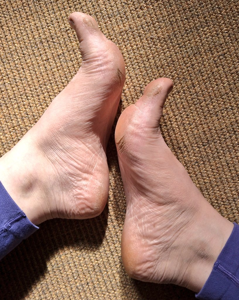 skye_fallin's tweet photo. Hi 👋 I'm new here. Going to be sharing my feet pics for all you foot enthusiasts out there! 🐾
#footfetish #feetworship #feetfinder #footpics #dirtyfeet https://t.co/mB8M2BHfDF