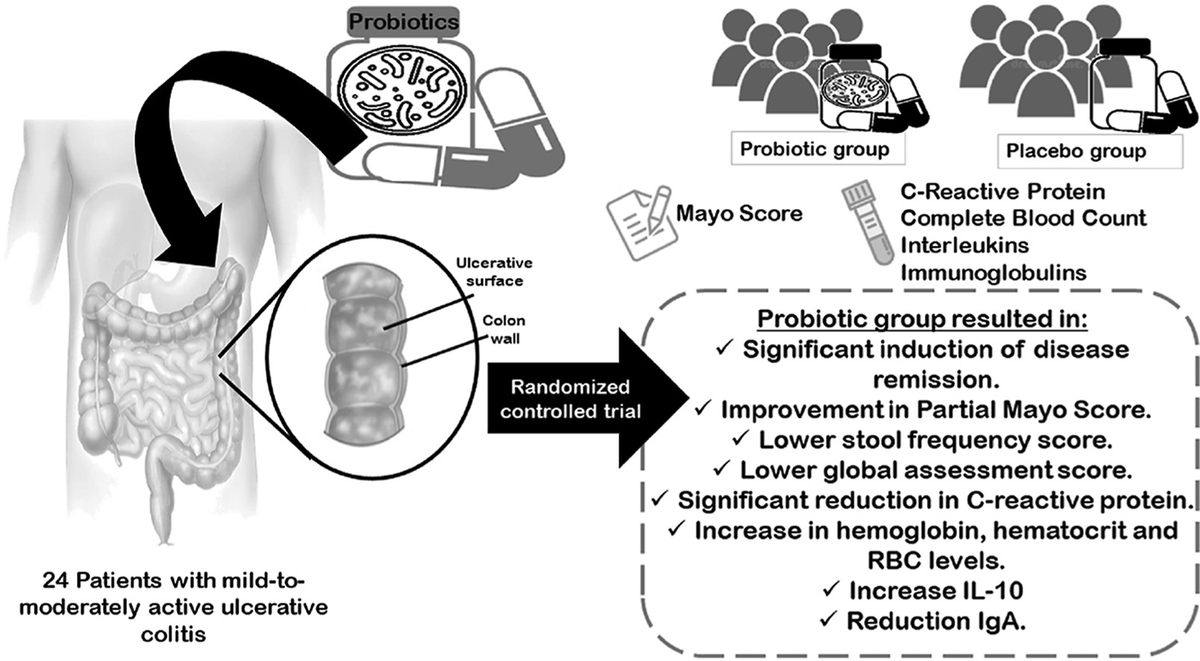 john_damianosMD's tweet image. A multi-strain #probiotic (9 Lactobacillus strains ➕ 5 Bifidobacterium strains) successfully induced remission in mild-moderate ulcerative colitis, and also ⬇️CRP, ⬆️hemoglobin, ⬇️IgA, and ⬆️IL-10. 

#MedTwitter #GITwitter #IBD #microbiome #probiotics

sciencedirect.com/science/articl…
