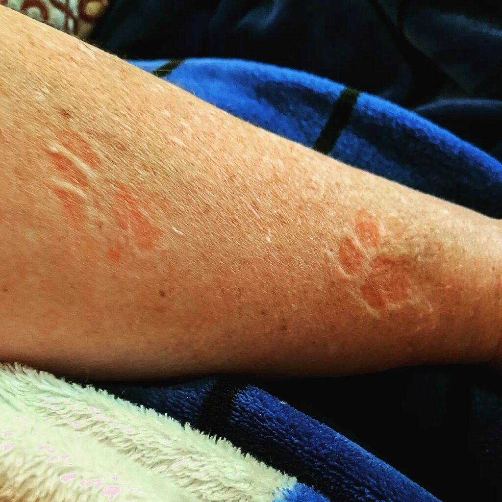mabjustmab's tweet photo. #Murderbeast sleeping on me so hard he has embedded himself into my arm. I've been marked. https://t.co/BaD6xPbL7b https://t.co/oHU84YVUpy