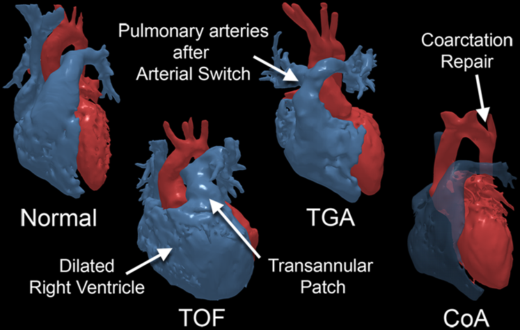 UPMC Heart and Vascular Institute tweet media