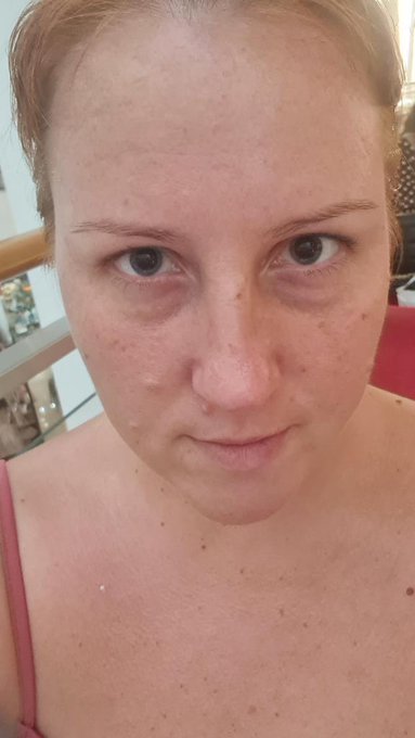 after my eyes were dripped, I stopped seeing normally.... https://t.co/qj0OE6rAEv