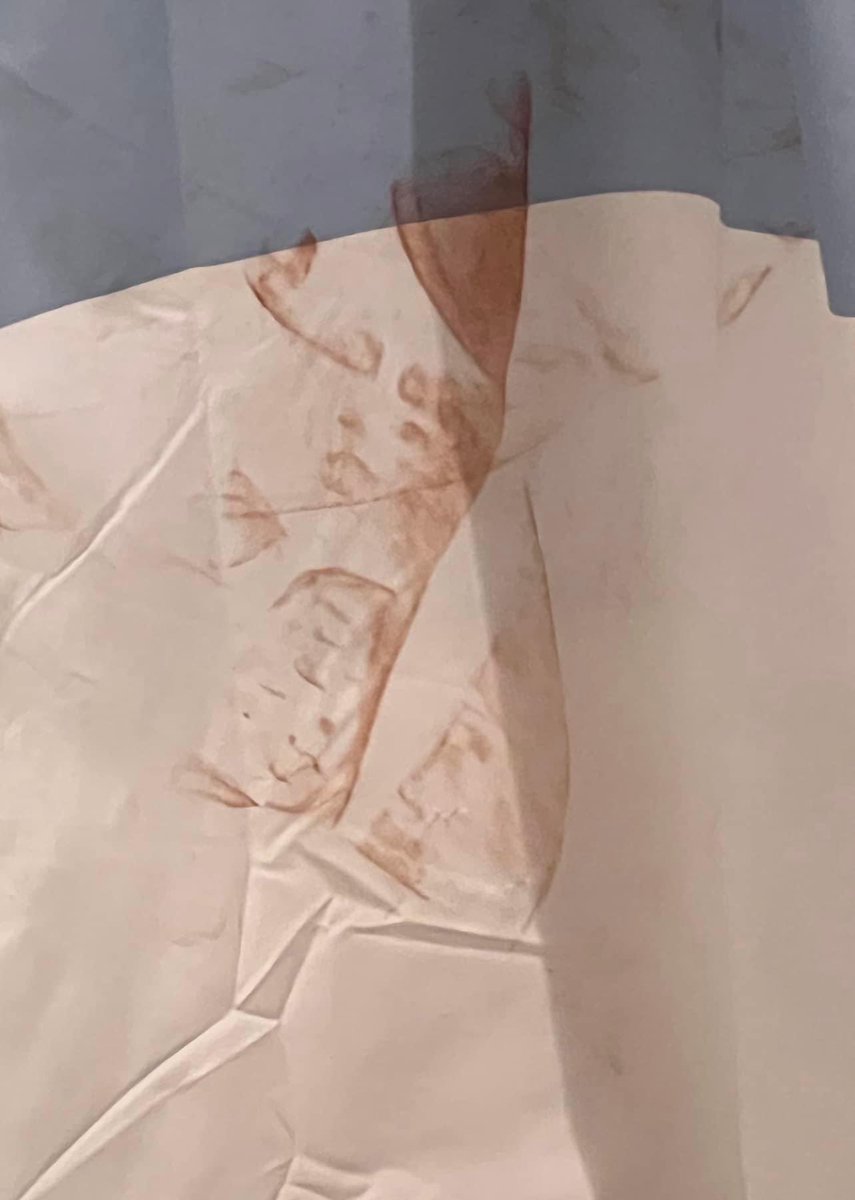 tamswhit's tweet photo. How many faces do you see? https://t.co/7fAJTyUCkq