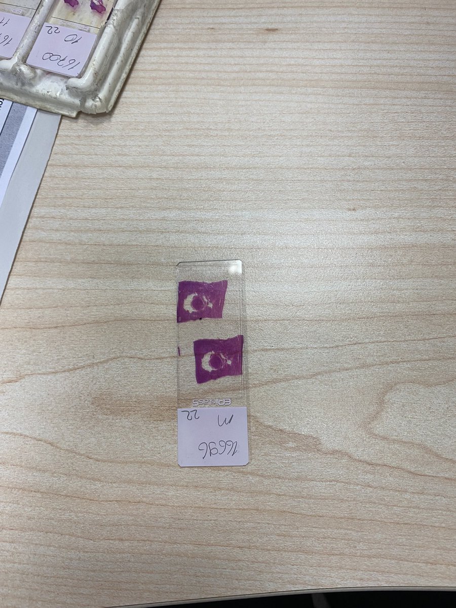 sumy_er's tweet photo. İlk biyopsime yakışır bir şov https://t.co/4heK16MIEk