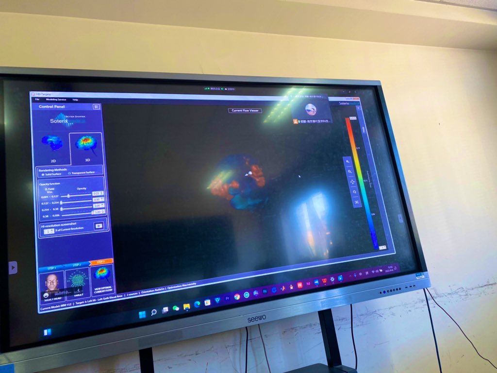 Brainsaise's tweet photo. I am training #MxN33 and #HDIFS equipment in Beijing today, and it is my great honor to learn and communicate with China 's top experts and researchers.#HDtES #HDIFS @SoterixMedical https://t.co/YvweYTrzhh