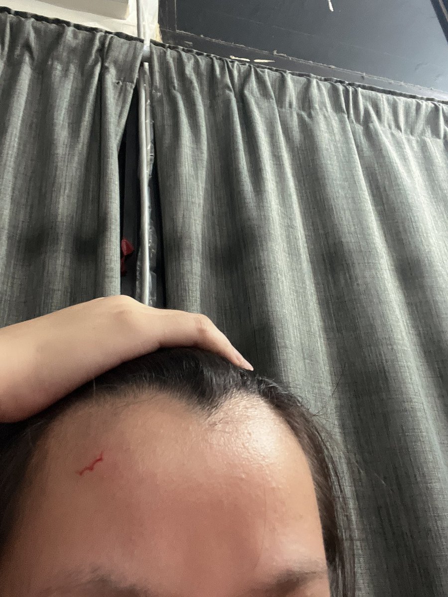 好好笑 為了開這 然後就被蓋子彈到

還是瓶蓋的形狀 https://t.co/ZIFE3NW972