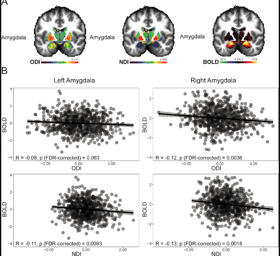 Aristotle Voineskos (@avoineskos) on Twitter photo Some of our latest work in <a href="/NeuroImage_EiC/">NeuroImage</a> led by <a href="/ChristinSchifa1/">Christin Schifani</a> with @ColinHawco & <a href="/Rshnzr/">Ārash Nazeri</a>. We examined relationships b/w neurite architecture (NODDI) and the task-based fMRI BOLD signal using <a href="/HumanConnectome/">HCP News</a> data. <a href="/camhresearch/">CAMH Research</a>.
sciencedirect.com/science/articl… Some of our latest work in <a href="/NeuroImage_EiC/">NeuroImage</a> led by <a href="/ChristinSchifa1/">Christin Schifani</a> with @ColinHawco & <a href="/Rshnzr/">Ārash Nazeri</a>. We examined relationships b/w neurite architecture (NODDI) and the task-based fMRI BOLD signal using <a href="/HumanConnectome/">HCP News</a> data. <a href="/camhresearch/">CAMH Research</a>.
sciencedirect.com/science/articl…
