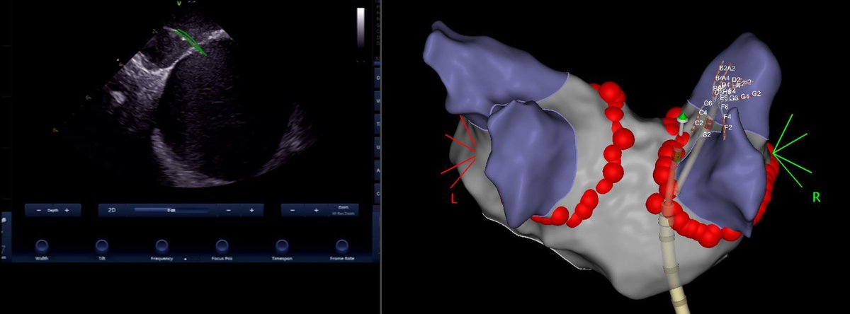 RDUH Electrophysiology Team tweet media