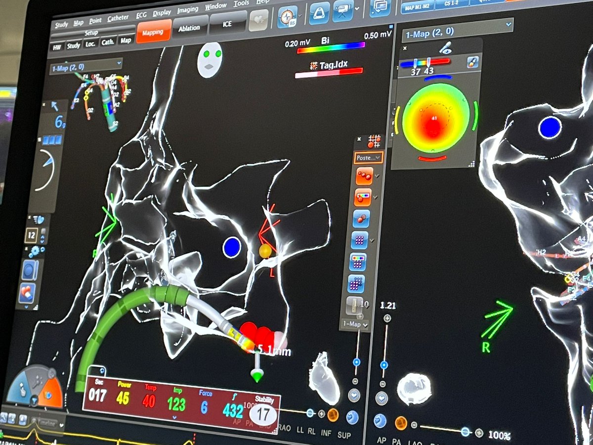 RDUH Electrophysiology Team tweet media