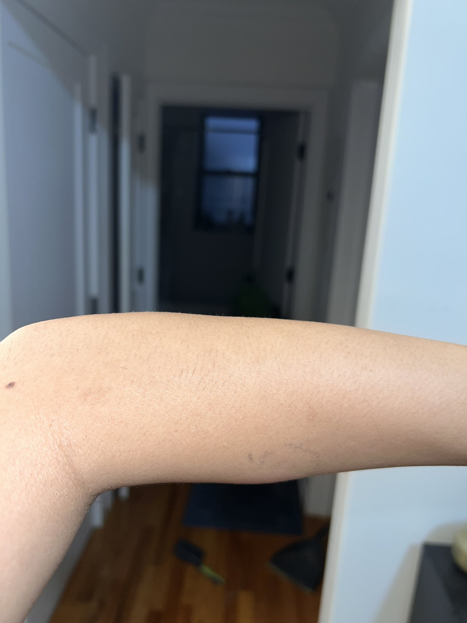 reversecowgirl69-on-twitter-day-2-well-we-hav-the-lump-it-does