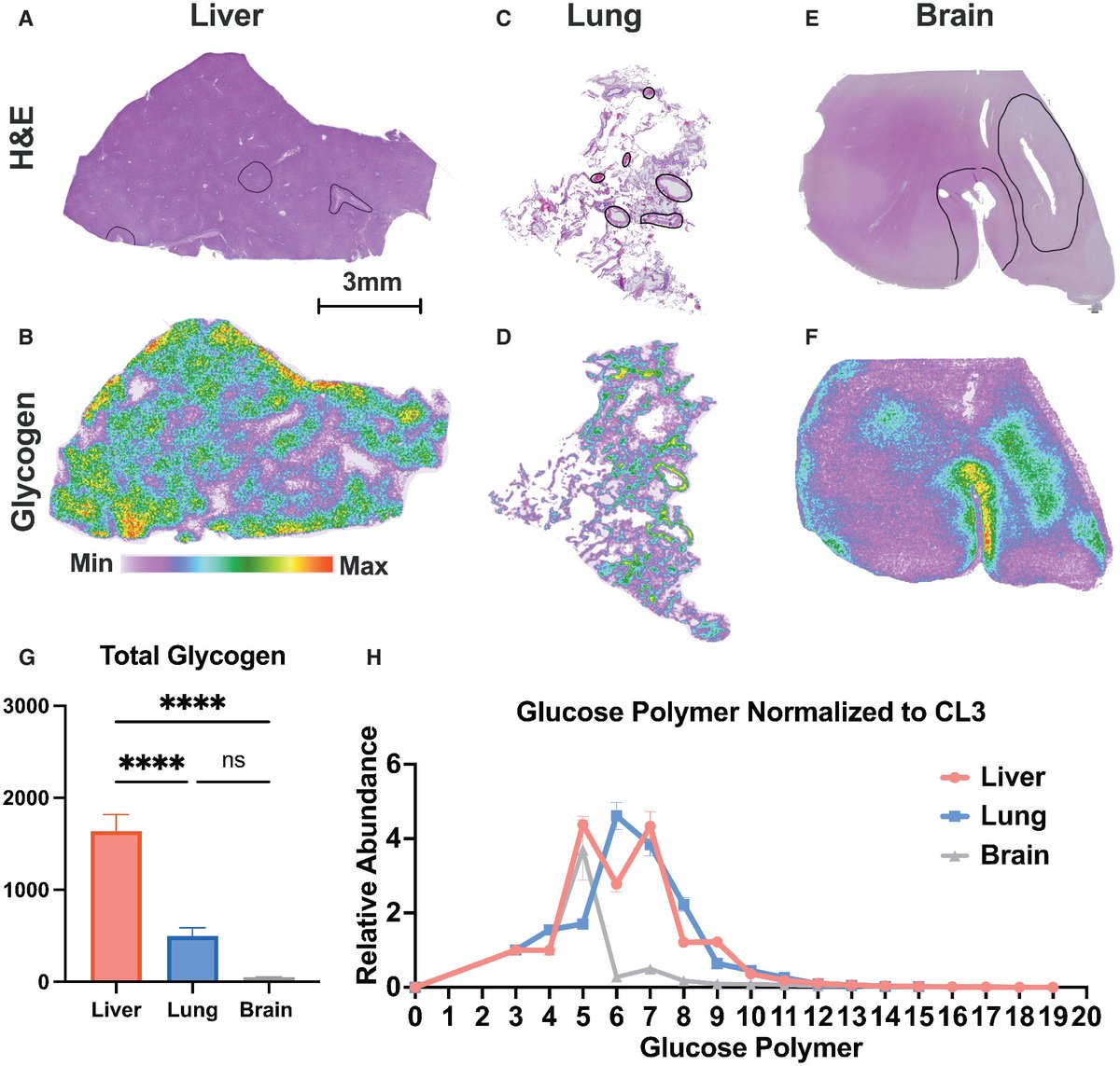 Ramon Sun (@rcsunlab) on Twitter photo Glad to finally see this exciting collaboration with the Gentry lab out in <a href="/EmboMolMed/">EMBO Mol. Medicine</a> . We are "perfecting the wheel" in spatial glycogen quantitation and metabolism. #spatialbiology #MSImaging #glycogen #glycotime <a href="/IMSSNews/">Imaging MS Society</a>
embopress.org/doi/full/10.15… Glad to finally see this exciting collaboration with the Gentry lab out in <a href="/EmboMolMed/">EMBO Mol. Medicine</a> . We are "perfecting the wheel" in spatial glycogen quantitation and metabolism. #spatialbiology #MSImaging #glycogen #glycotime <a href="/IMSSNews/">Imaging MS Society</a>
embopress.org/doi/full/10.15…