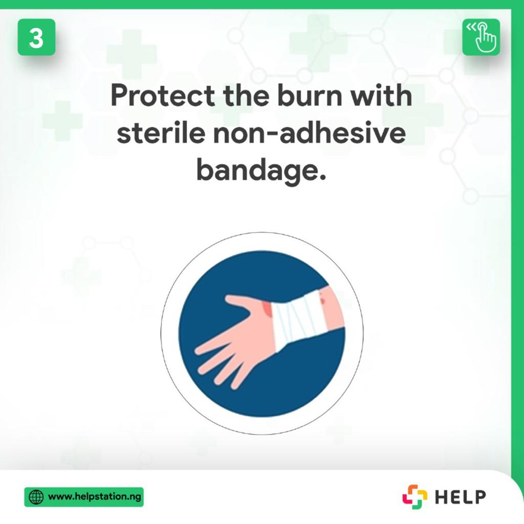 help_station_'s tweet photo. A burn is an injury to the skin or other organic tissues, primarily caused by heat due to fire, hot liquids, steam etc  These are some tips on what to do in a burns situation.

#HELPonthego #HELPisontheway #emergencyservices #emergencysercicesinlagos #emergencyservicesinnigeria https://t.co/ajsRhcu546
