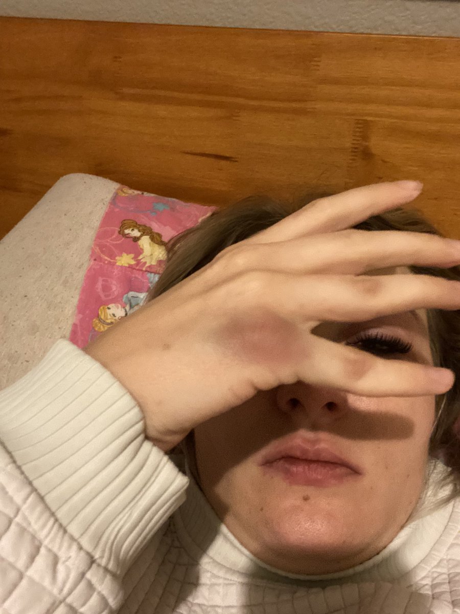 MIRRmaid_'s tweet photo. Found out my boyfriends a cheater on my birthday, hit him in the face 🥰 https://t.co/DFmFse8OIx