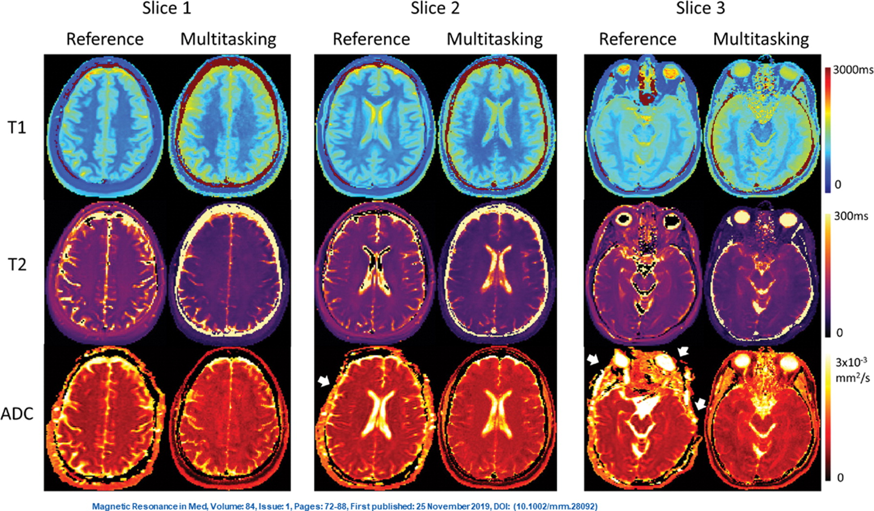 Radiology on twitter whole brain multiparametric quantitative mri