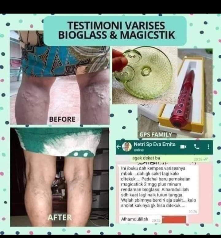 HartonoVera10's tweet photo. Atasi Varises + Vertigo Pake Obat ❌
Atasi Varises + Vertigo Pake Produk MCI ✔️
Free konsultasi
https://t.co/fdGJFzMgO1
#varises #vertigo #mci #alami https://t.co/paf6gShbl6