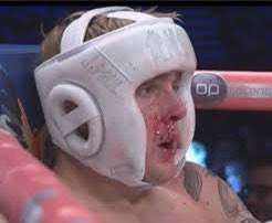 LeoGriffiths11's tweet photo. @wodoi_ @KSI Don’t forget what this guy did to Jake silly https://t.co/CKrIh9btuN