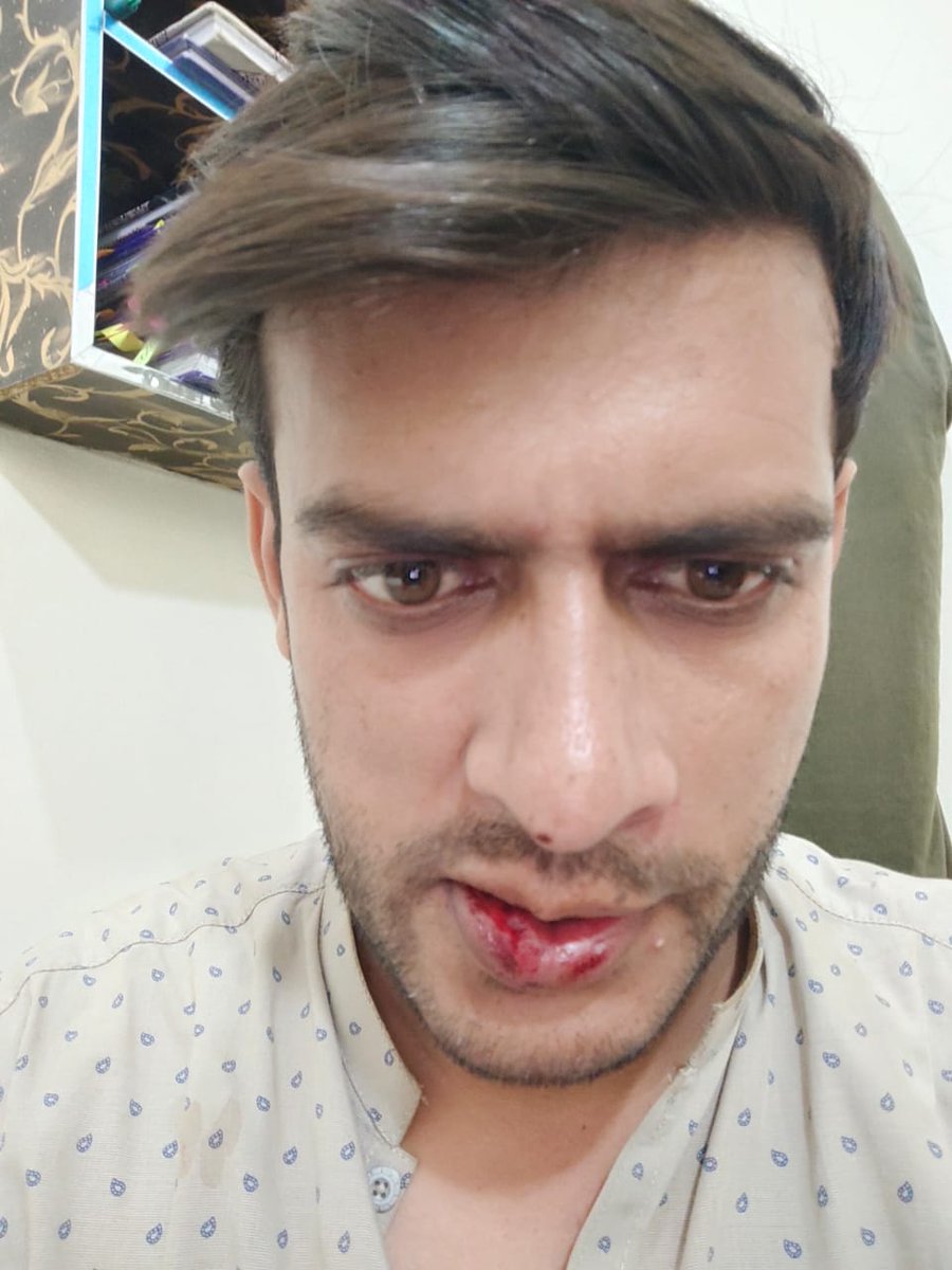 Ch_Ali_Ahmad's tweet photo. عتیق گورنمنٹ سکول میں ٹیچر ہیں اور دو دن پہلے انکی یونیورسٹی وین پر مسلحہ افراد نے حملہ کیا جوکہ بھمن شاہ کے رہائشی ہیں گاڑی کے شیشے توڑ دئے اور عتیق کو جان سے مارنے کی کوشش کی
ایف آئی آر درج ہوچکی ملزموں کے نام پتے دے دیئے لیکن پولیس گرفتاری سے انکاری ہیں۔ 1/2
@OfficialDPRPP https://t.co/SLyc4HlBjO