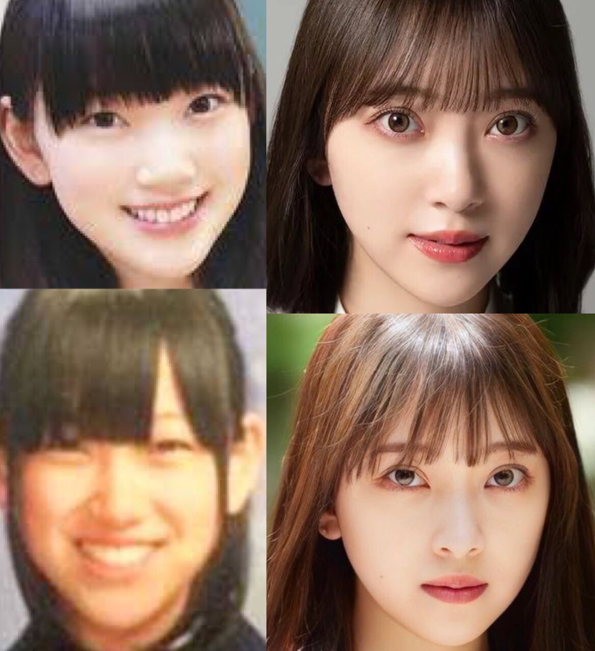 堀 未 央奈 整形