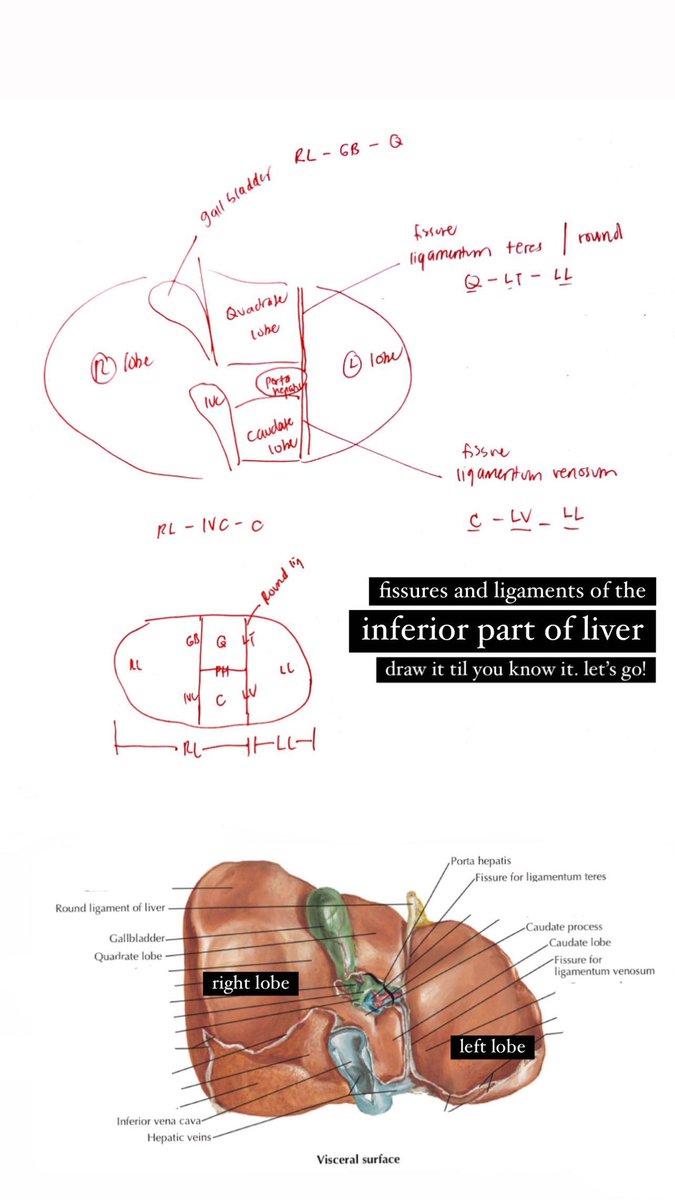 npdmd2022's tweet photo. #anatomy of the liver is really complex. Has anatomical and functional lobes and segments.

Here’s some of compiled simpler diagrams that hopefully would help. 😁

#PLE2022 https://t.co/v5ptZq84Rc