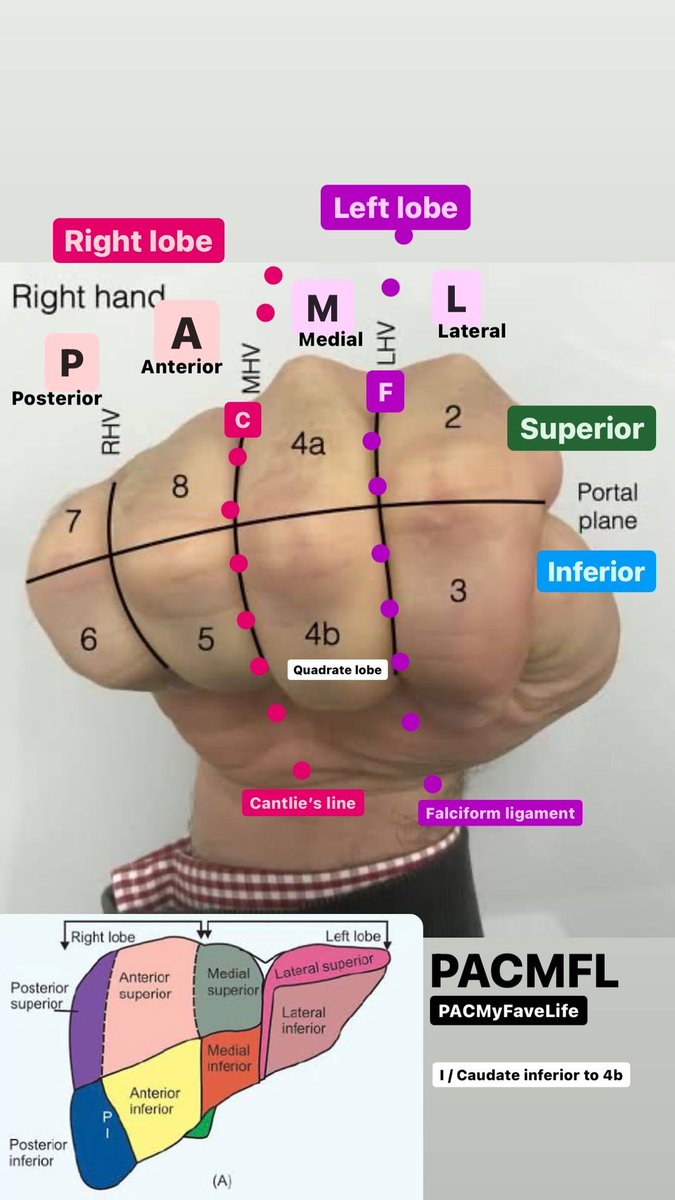 npdmd2022's tweet photo. #anatomy of the liver is really complex. Has anatomical and functional lobes and segments.

Here’s some of compiled simpler diagrams that hopefully would help. 😁

#PLE2022 https://t.co/v5ptZq84Rc