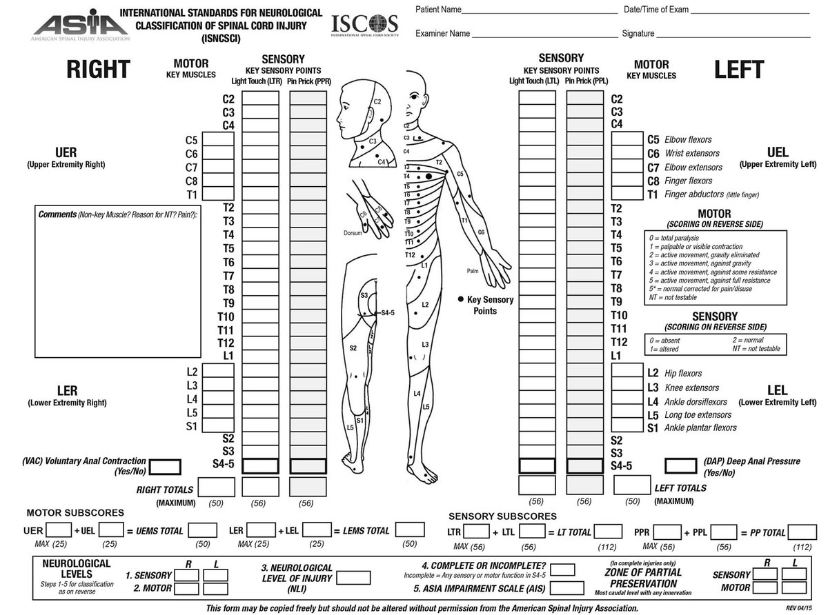 PeteReed's tweet photo. Day 4/30
ASIA Score.
A way to broadly categorise level & magnitude of all unique SCIs.
GENERALLY, lower on cord, and lesser injuries are better. More neural bandwidth to more of the body is good.
Scene set. Let’s start our adventure.
#SCIawarenessmonth
#4Sep22
#Onwards https://t.co/P80u5aeb9S