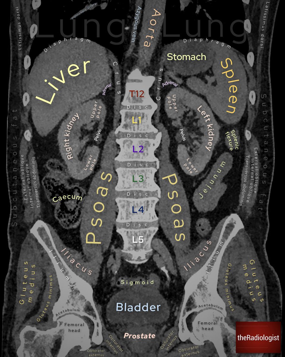 Coronal abdominal CT anatomy
