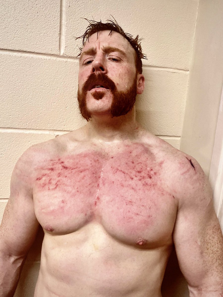 smFISHMAN's tweet photo. Whenever someone tells me pro wrestling fake, I’m just going to respond back with Sheamus …. https://t.co/cGhfypkvrk