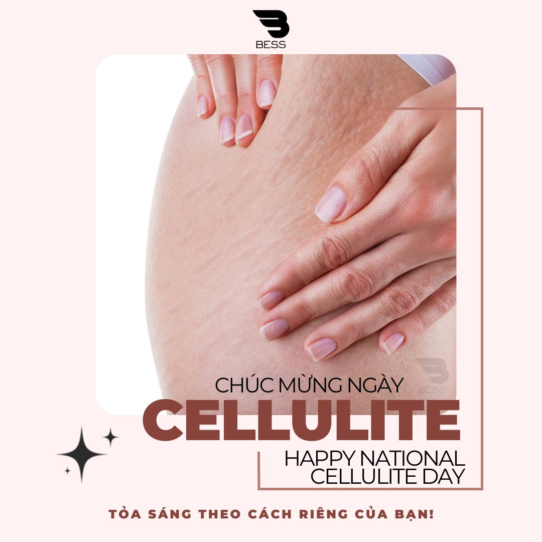 thisisbalmistry's tweet photo. 👉 Bạn có biết rằng 90% phụ nữ bị cellulite?  https://t.co/jEzRuB3nah 

 #BESSOFFICIAL #cellulite #beauty #bodycontouring #skincare #benessere #cellulitetreatment #skintightening #fitness #cellulitereduction #bellezza #weightloss #bodysculpting 

*Nguồn: nationaltoday https://t.co/7SCmrAccUI