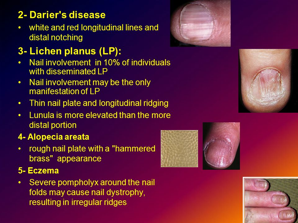 Healthy Nails: Detecting Complications and Diseases