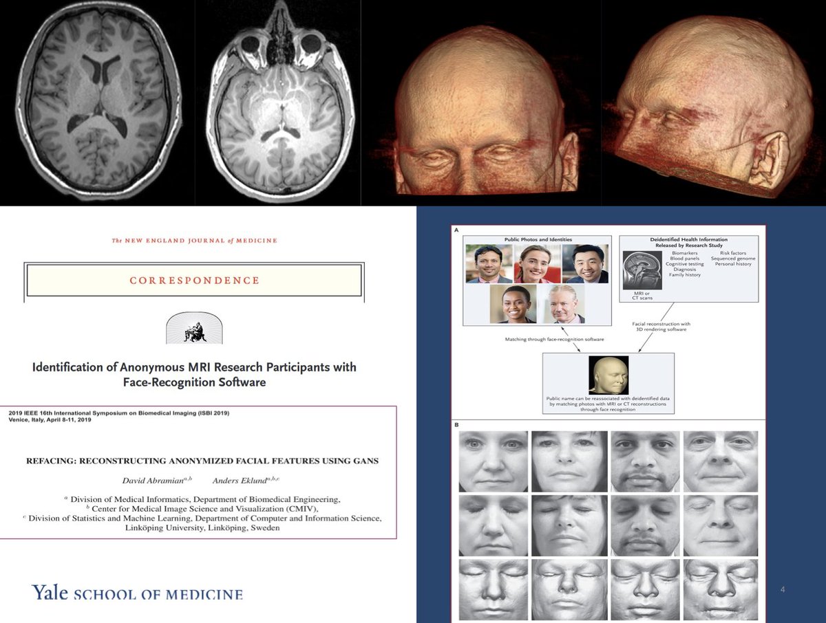 NTillmanns's tweet photo. (3/4) I also recommend our educational exhibit that provides background on patient data ownership in the EU and US as it relates to AI research in neuroradiology in the #Whova app @theASFNR @MariamAboian @radiology_ninja @maxkallinich #ASFNR22 https://t.co/7aTkasoqJT