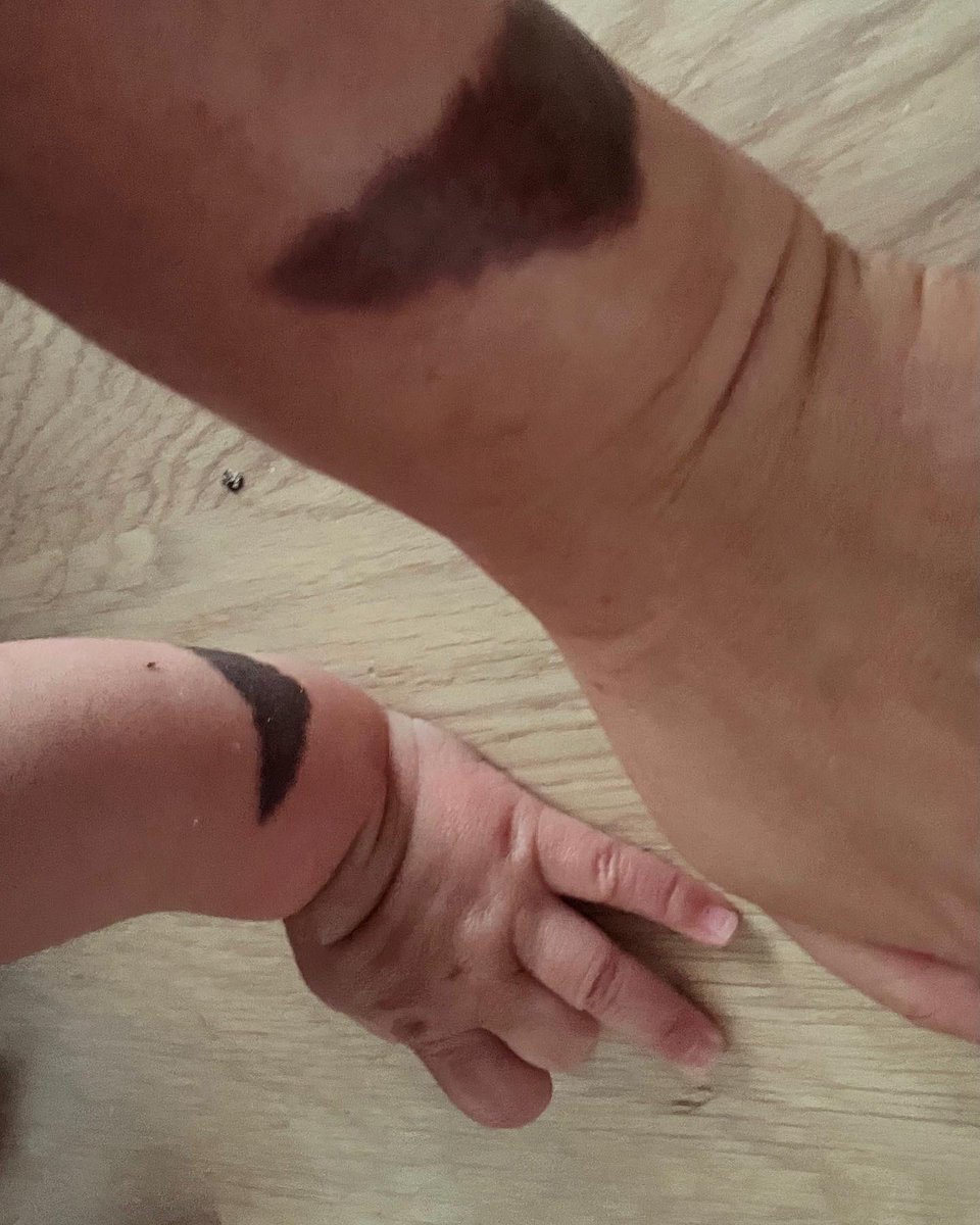 KHDawson1's tweet photo. So, yesterday Simon from #Tribe2 created this wonderful tattoo replica of my boy’s amazing birthmark. Just because I wanted to be like my cool dude son. #Batman #tattoo https://t.co/R676UyhqtM