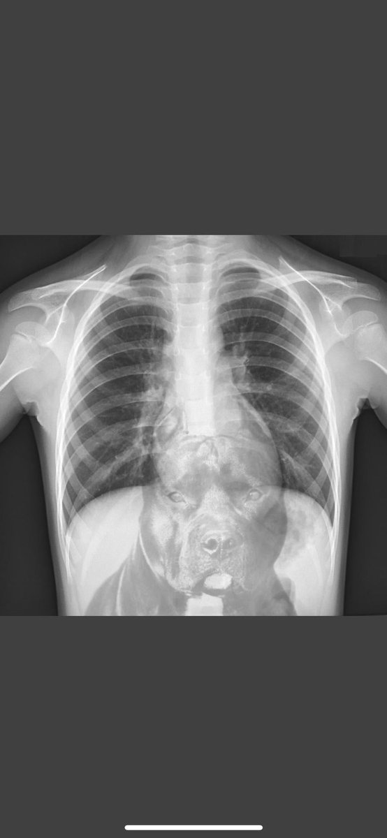 After taking those arrows, Daemon’s X-rays came back. #HouseoftheDragon