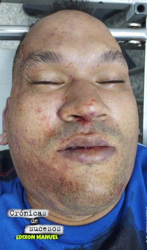 InforTvenezuela's tweet photo. 3 Sujetos ladrones de vehiculos resultaron exterminados al enfrentarse a comisiones del Cicpc delegaciones de El Tigre y de Maturín,la banda de ladrones eran del estado Monagas.
Juan Jimenez,Victor Gómez y uno con el alias de "El Ruso"
Los ladrones fueron abatidos en Maturín. https://t.co/gJVAjaRVUm