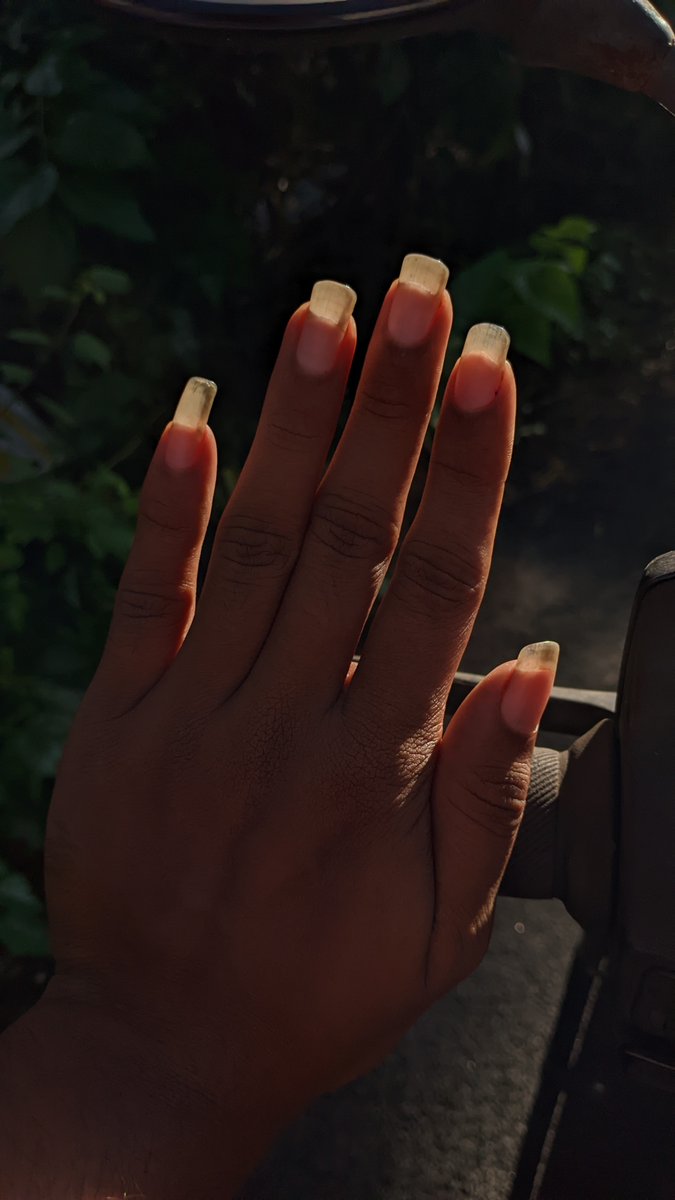 CosmicTomatoe's tweet photo. Growing longer by the day 🥵❤️
.
#longnails #nails #naturalnails #fingernails #boynails #kinkynails #nailfetish https://t.co/3xhs4Zxbi8