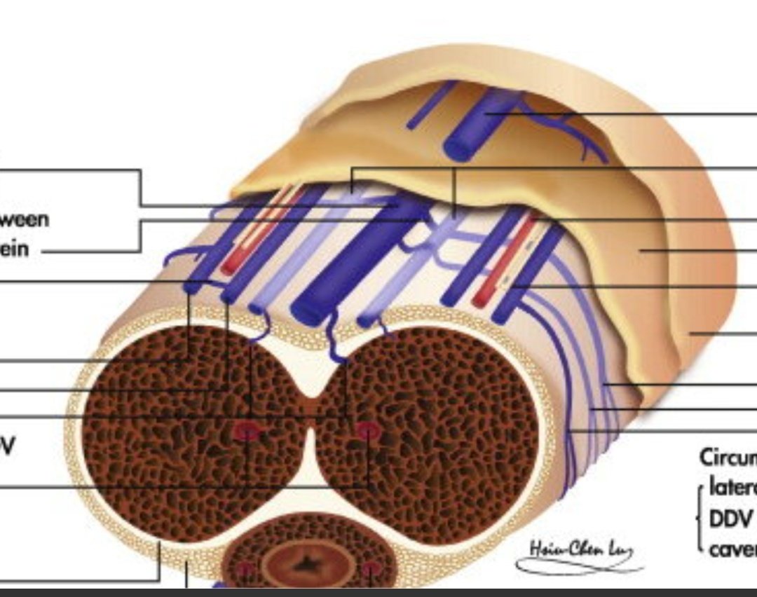 Bismillaah.
Kemarin kan dah bicara mengenai komplikasi DM terhadap gangguan ereksi. Nah pagi ini sy...