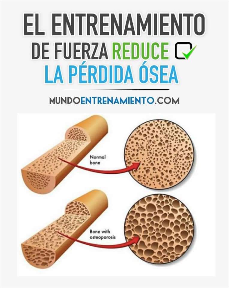 angelorunner's tweet photo. Sabías que el ejercicio de resistencia correctamente dosificado tiene un efecto positivo en la densidad ósea. 
Mejora postura y balance.
Protege articulaciones. 
Mejora la fuerza y potencia. 
Reduce riesgo de caídas.
Disminuye proceso degenerativo del sistema esquelético. https://t.co/DT74t5M0rx