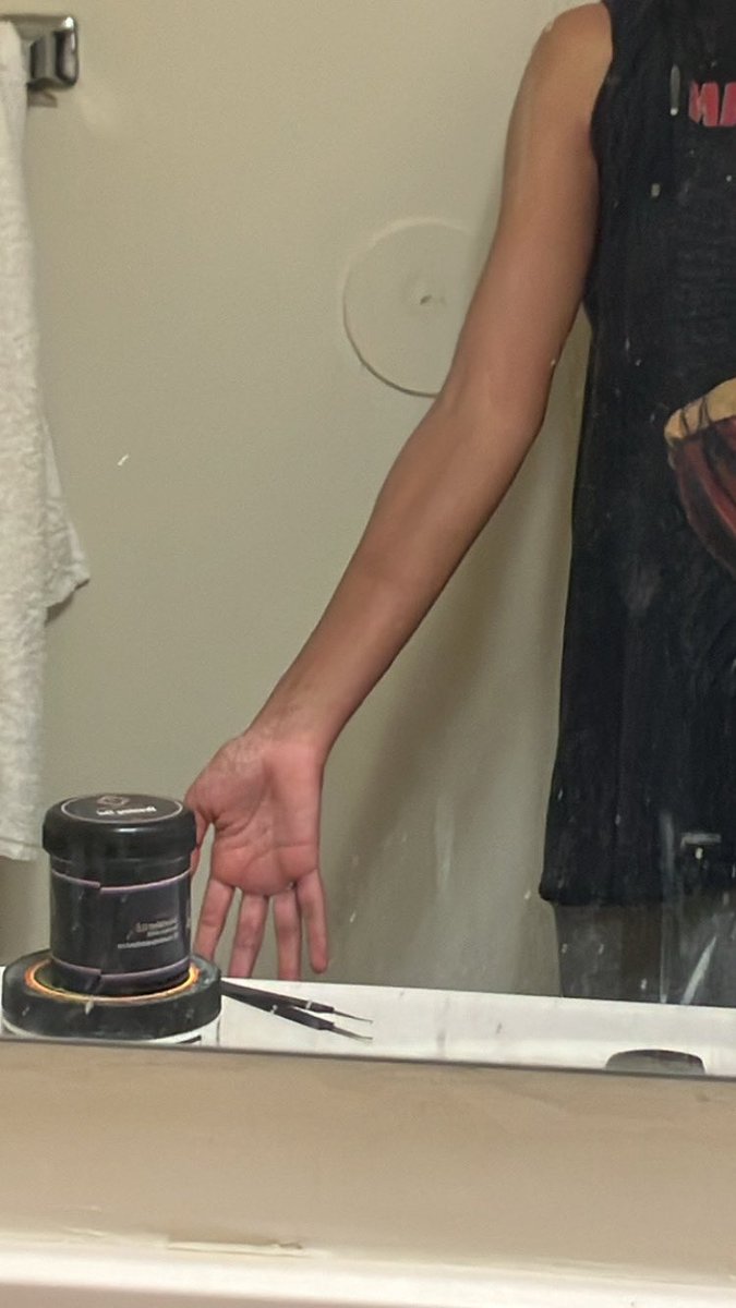 angelanemia's tweet photo. [repost] arm checking https://t.co/BfCGa0kDma