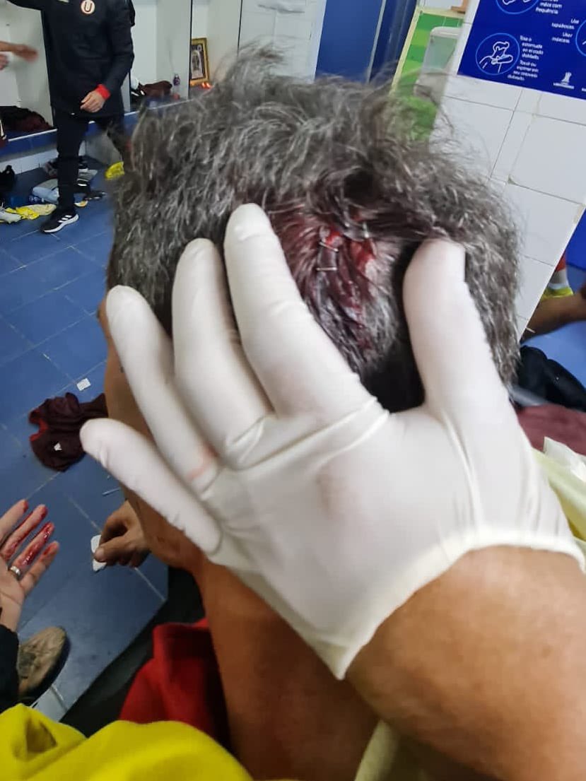 jferrari5's tweet photo. Un triunfo se disfruta, las agresiones se denuncian y castigan, lo de hoy es injustificable, enviaremos nuestra queja y solicitud a liga 1 y comisión de disciplina FPF por lo acontecido en Matute,nuestro PF y futbolista R. Vilca fueron agredidos. Esto no debe pasar desapercibido. https://t.co/i0qfHgmHiq