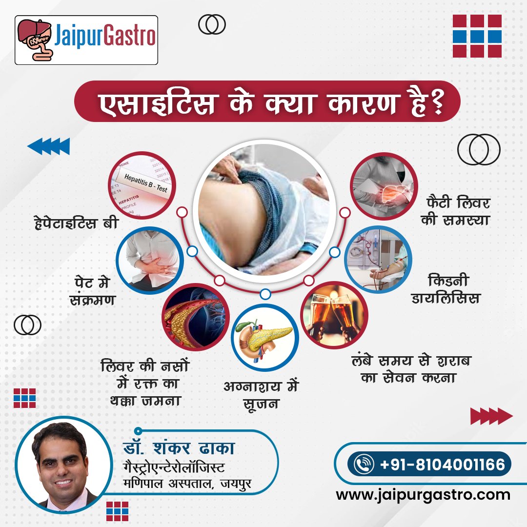 JaipurGastro's tweet photo. #एसाइटिस के क्या कारण है?

#Ascites #fattyliver #kidneydialysis #pancreas #hepatitisb #Gastroenterologist #Hepatologist #Endoscopist #Jaipur #JaipurGastro #gas #Acidity #ulcer #abdominalpain #Pancreatitis  #Gastroenteritis #GI #GICancer #Endoscopy #health #healthcare https://t.co/mZHNj9x0mc